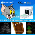 96ele ultrasound scanner low price & dw-360 portable ultrasound machine 12.1 inch LED HD screen